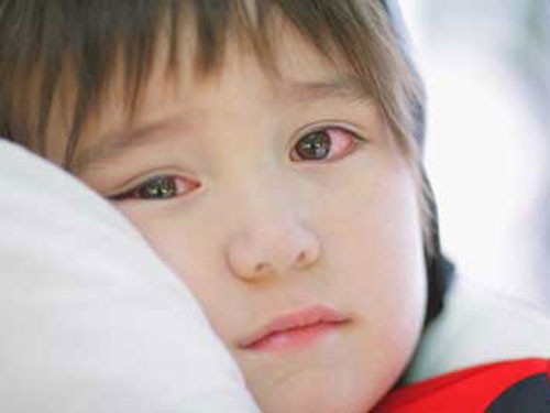 phòng bệnh đau mắt đỏ