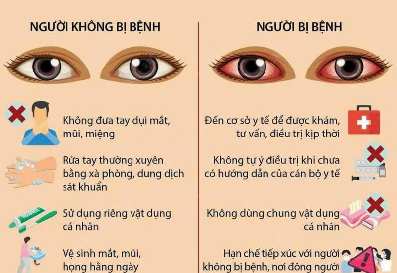 cách phòng tránh đau mắt đỏ